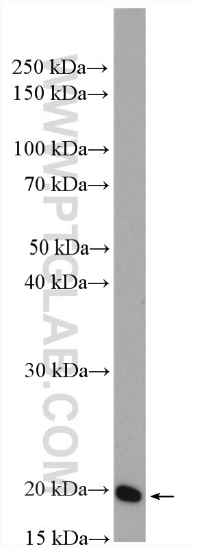 Western Blot (WB) analysis of MCF-7 cells using ARF5 Polyclonal antibody (15281-1-AP)