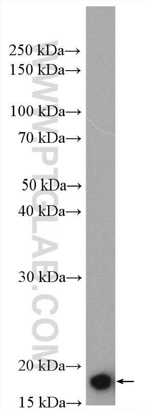 Western Blot (WB) analysis of mouse brain tissue using ARF5 Polyclonal antibody (15281-1-AP)