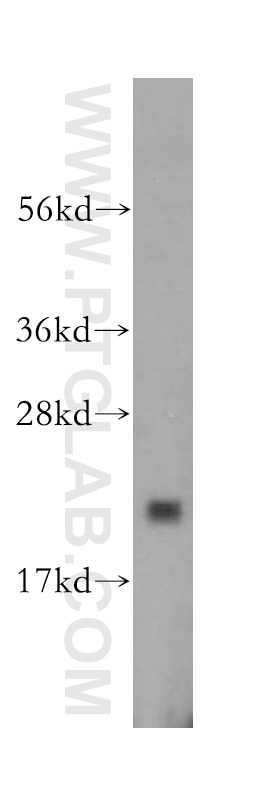 Western Blot (WB) analysis of HeLa cells using ARF5 Polyclonal antibody (15281-1-AP)