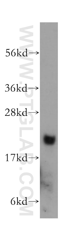 Western Blot (WB) analysis of human liver tissue using ARF5 Polyclonal antibody (15281-1-AP)