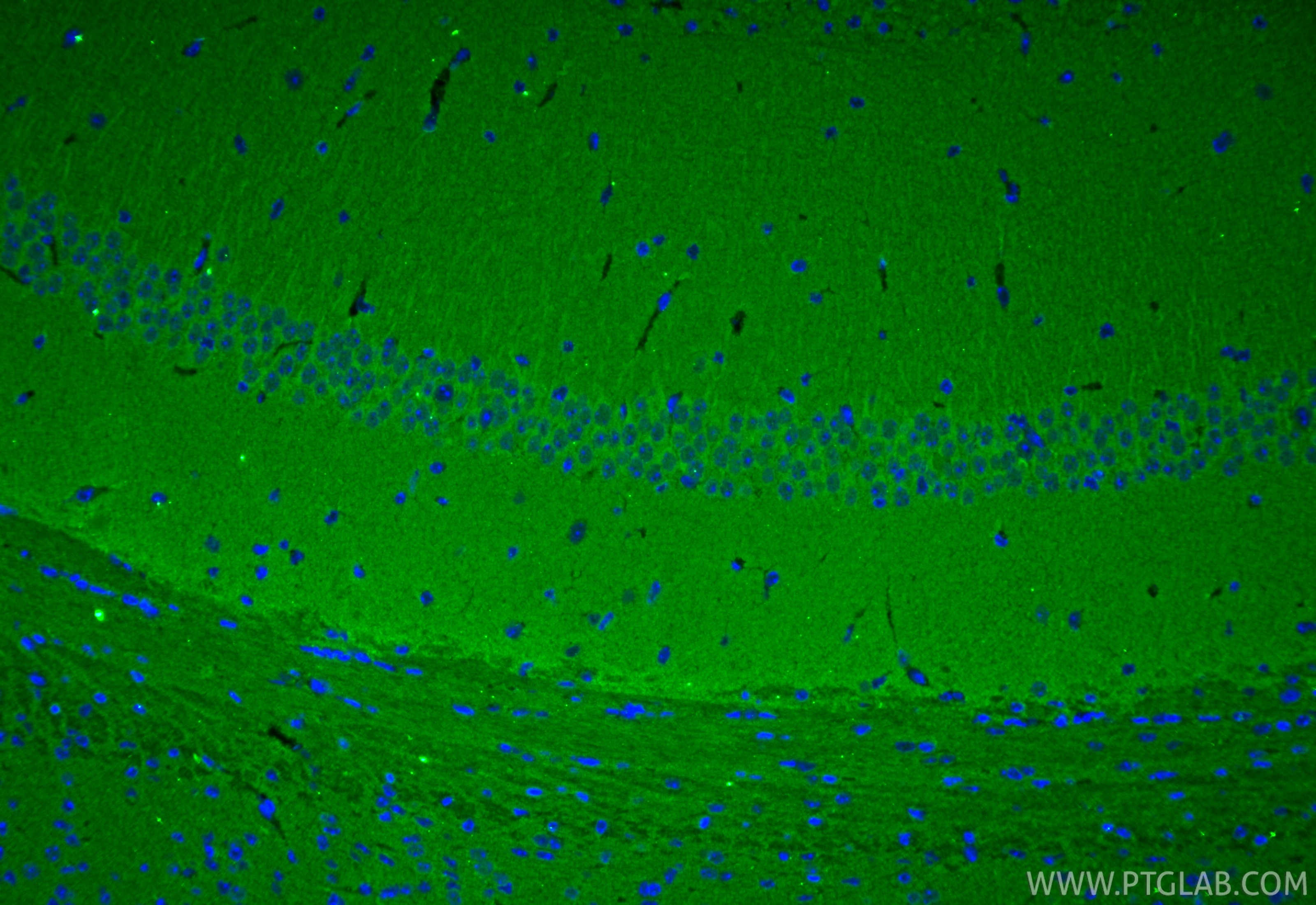 Immunofluorescence (IF) / fluorescent staining of mouse brain tissue using ARF5 Monoclonal antibody (67279-1-Ig)