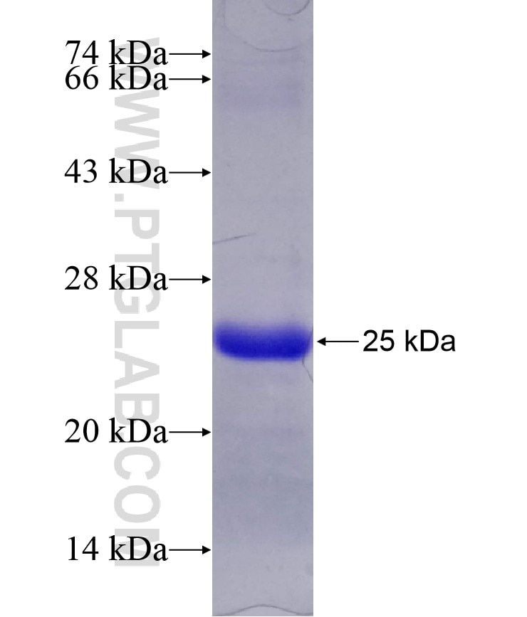 ARF5 fusion protein Ag7849 SDS-PAGE