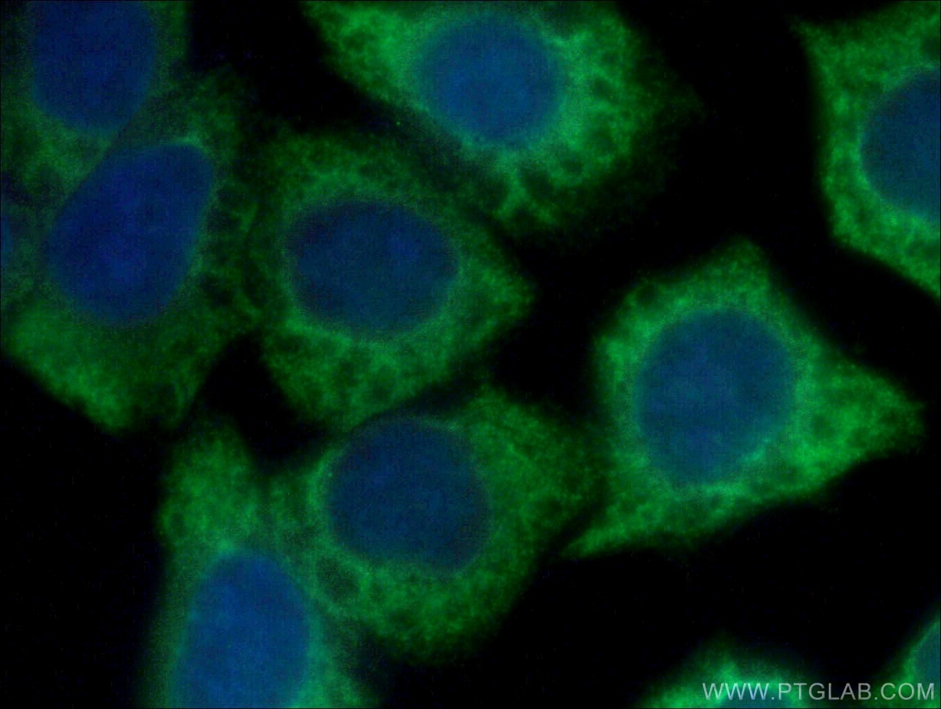 Immunofluorescence (IF) / fluorescent staining of HeLa cells using ARF5-Specific Polyclonal antibody (20227-1-AP)