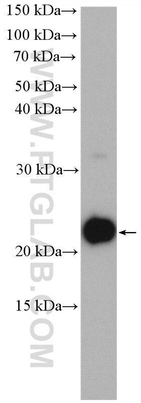 Western Blot (WB) analysis of HepG2 cells using ARF5-Specific Polyclonal antibody (20227-1-AP)