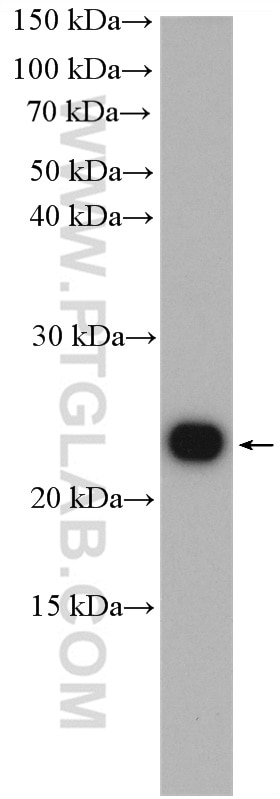 Western Blot (WB) analysis of HeLa cells using ARF5-Specific Polyclonal antibody (20227-1-AP)