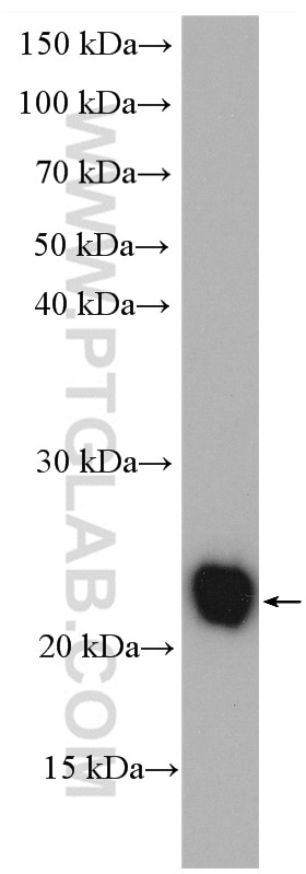 Western Blot (WB) analysis of mouse kidney tissue using ARF5-Specific Polyclonal antibody (20227-1-AP)