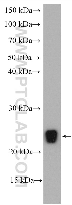 Western Blot (WB) analysis of mouse liver tissue using ARF5-Specific Polyclonal antibody (20227-1-AP)