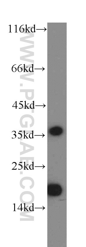 Western Blot (WB) analysis of mouse brain tissue using ARF5-Specific Polyclonal antibody (20227-1-AP)