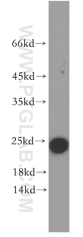 Western Blot (WB) analysis of COLO 320 cells using ARF5-Specific Polyclonal antibody (20227-1-AP)