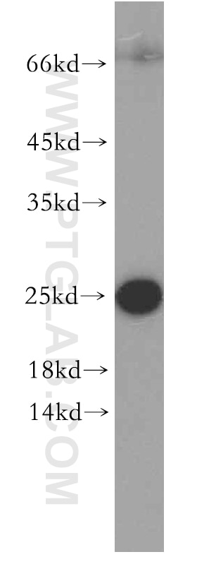 Western Blot (WB) analysis of human testis tissue using ARF5-Specific Polyclonal antibody (20227-1-AP)