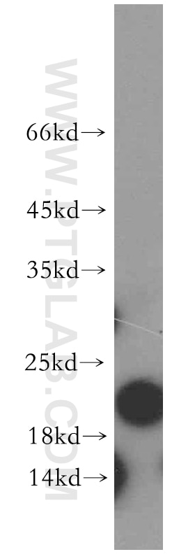 Western Blot (WB) analysis of mouse colon tissue using ARF5-Specific Polyclonal antibody (20227-1-AP)