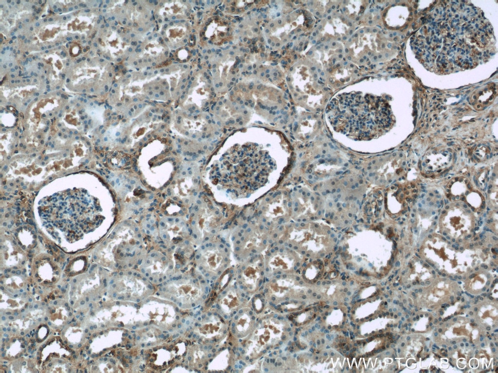 Immunohistochemistry (IHC) staining of human kidney tissue using ARF6-Specific Polyclonal antibody (20225-1-AP)