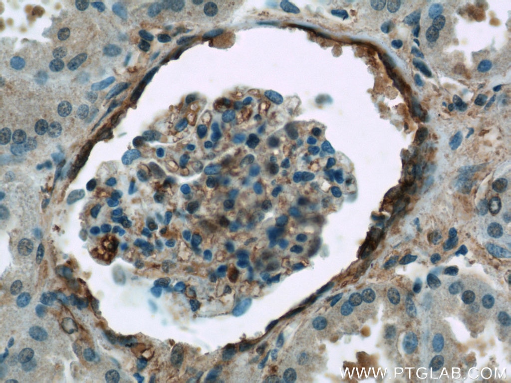 Immunohistochemistry (IHC) staining of human kidney tissue using ARF6-Specific Polyclonal antibody (20225-1-AP)