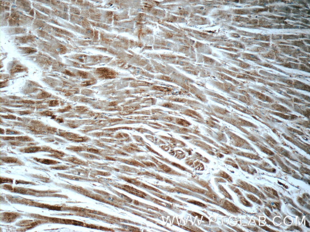 IHC staining of human heart using 20225-1-AP