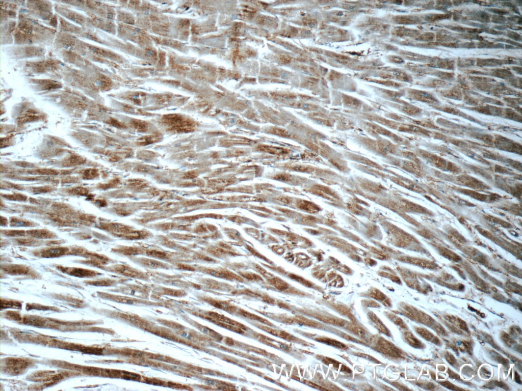 Immunohistochemistry (IHC) staining of human heart tissue using ARF6-Specific Polyclonal antibody (20225-1-AP)