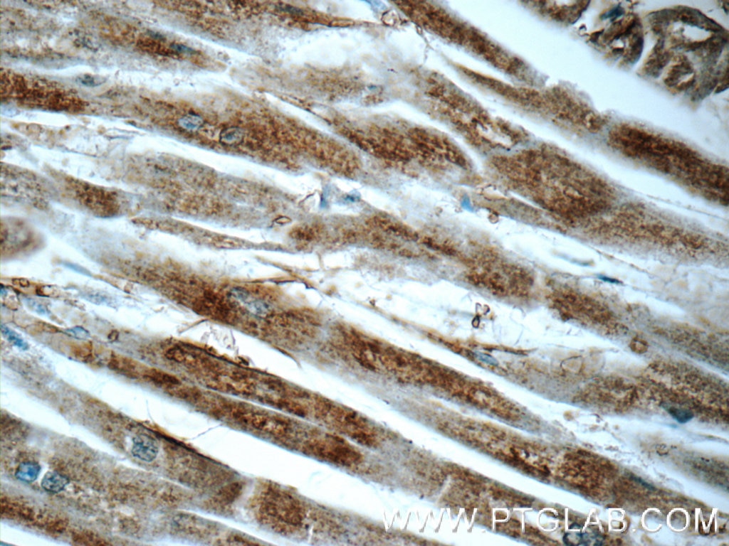 Immunohistochemistry (IHC) staining of human heart tissue using ARF6-Specific Polyclonal antibody (20225-1-AP)