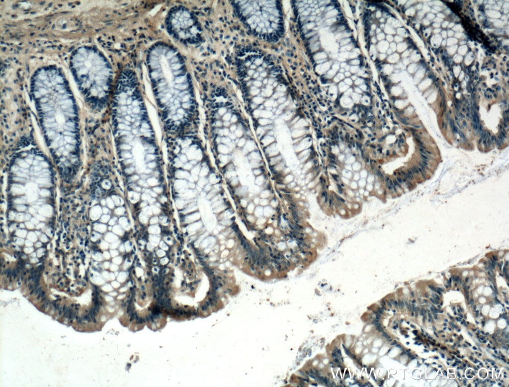 IHC staining of human colon using 20225-1-AP