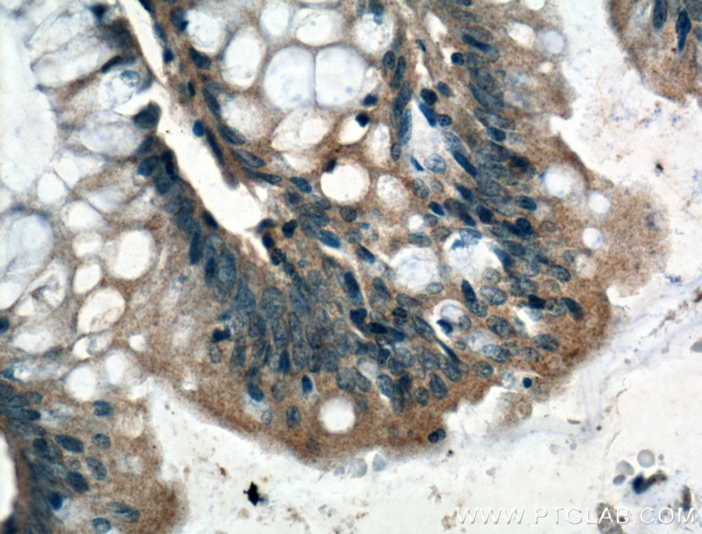 Immunohistochemistry (IHC) staining of human colon tissue using ARF6-Specific Polyclonal antibody (20225-1-AP)