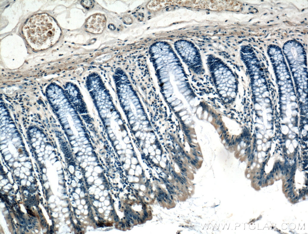 Immunohistochemistry (IHC) staining of human colon tissue using ARF6-Specific Polyclonal antibody (20225-1-AP)