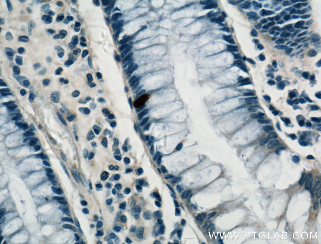 Immunohistochemistry (IHC) staining of human colon tissue using ARF6-Specific Polyclonal antibody (20225-1-AP)