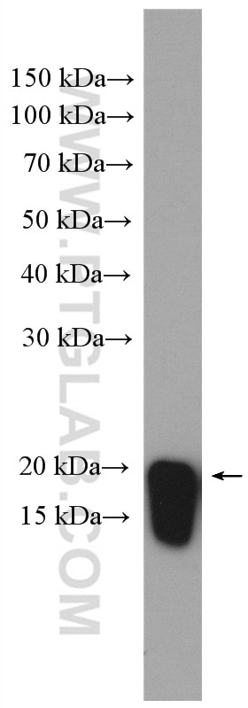 Western Blot (WB) analysis of mouse liver tissue using ARF6-Specific Polyclonal antibody (20225-1-AP)