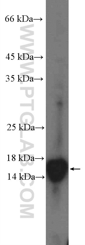 Western Blot (WB) analysis of MCF-7 cells using ARF6-Specific Polyclonal antibody (20225-1-AP)