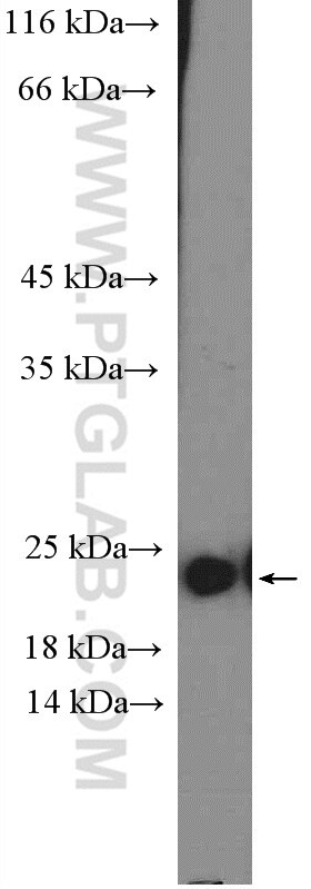 Western Blot (WB) analysis of HEK-293 cells using ARF6-Specific Polyclonal antibody (20225-1-AP)