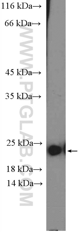 WB analysis of HEK-293 using 20225-1-AP