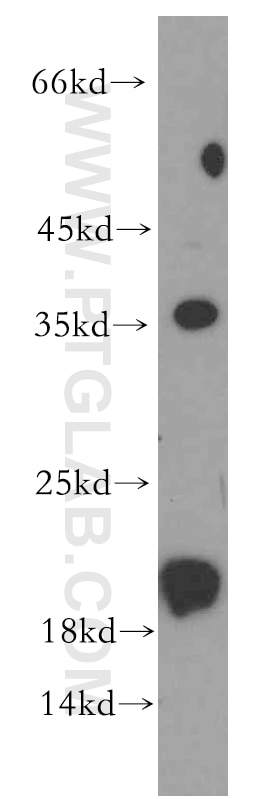 WB analysis of A549 using 20225-1-AP