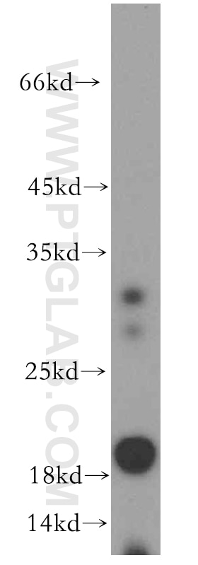 Western Blot (WB) analysis of human liver tissue using ARF6-Specific Polyclonal antibody (20225-1-AP)