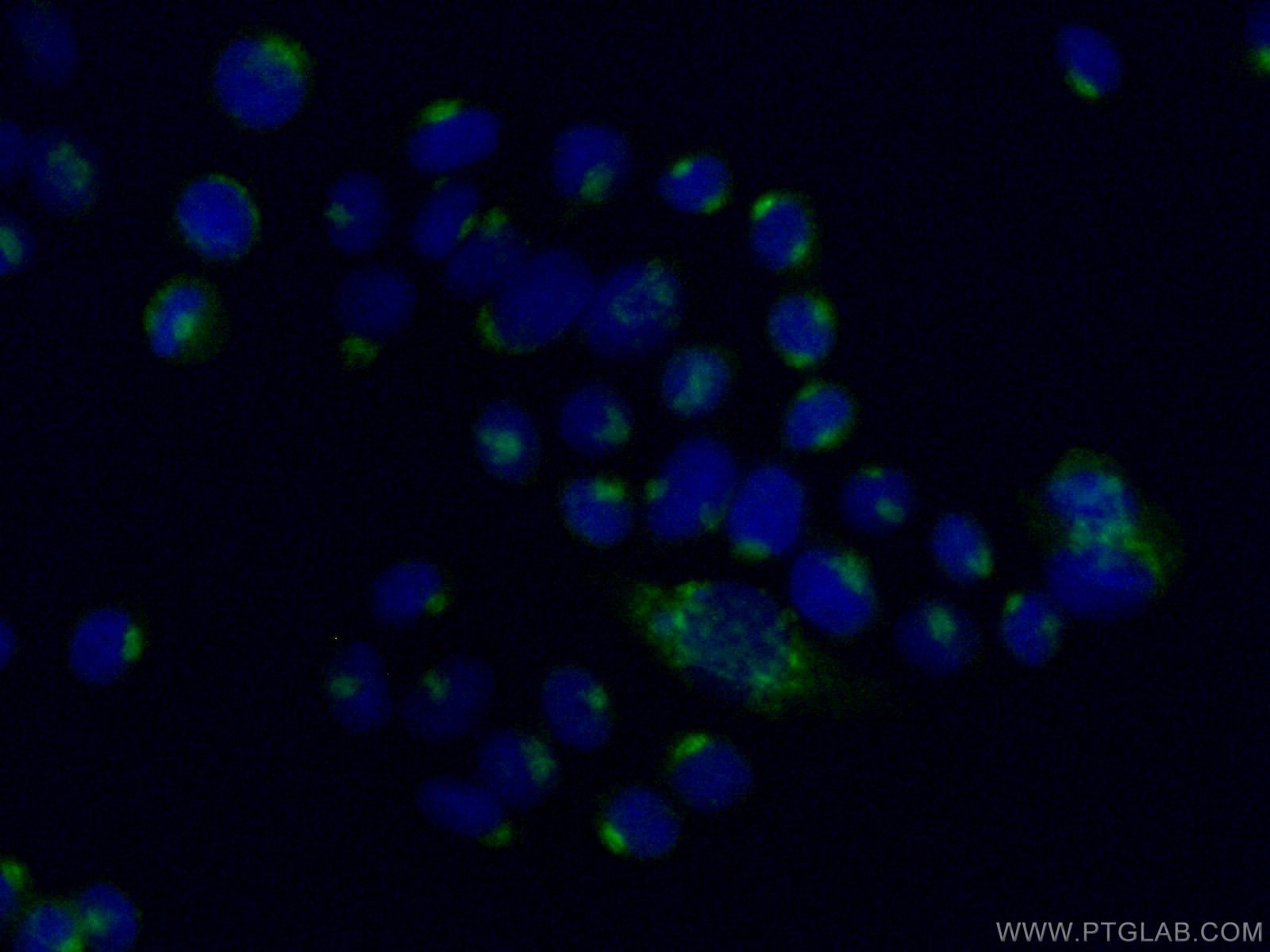 Immunofluorescence (IF) / fluorescent staining of HeLa cells using ARFGAP1 Polyclonal antibody (13571-1-AP)