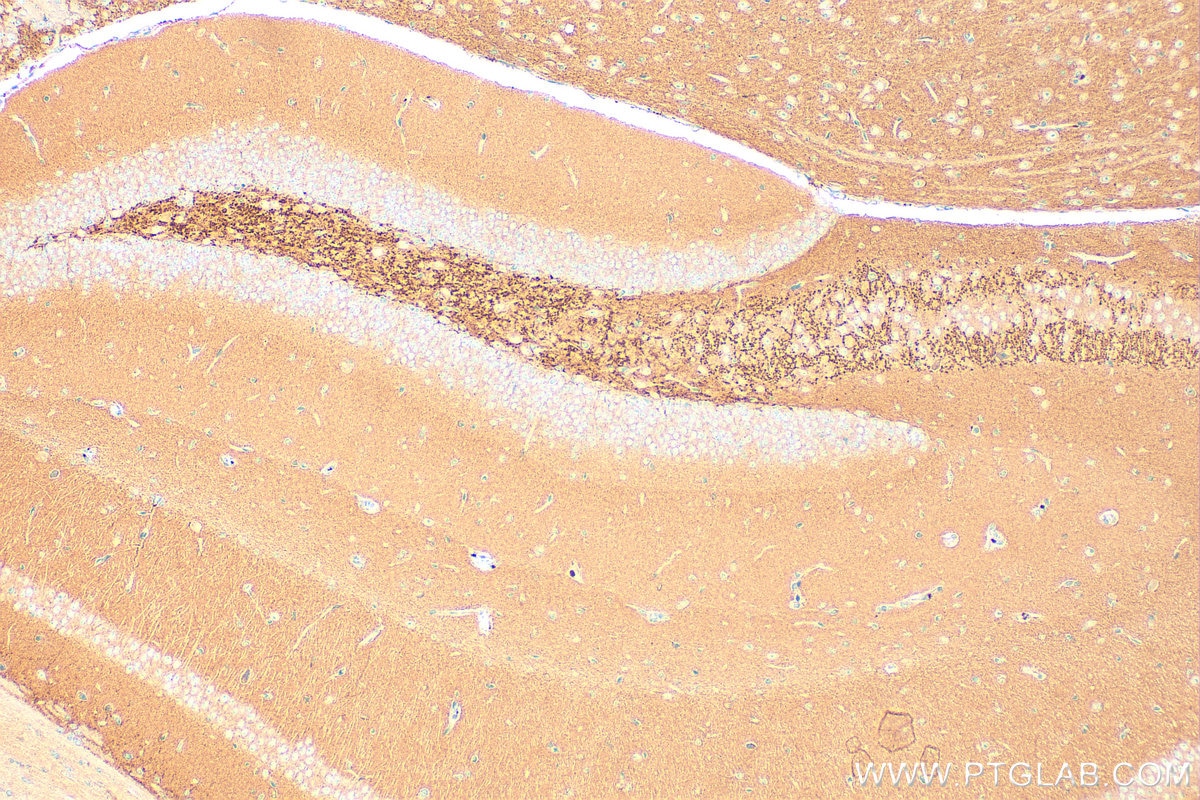 Immunohistochemistry (IHC) staining of mouse brain tissue using ARFGAP1 Polyclonal antibody (13571-1-AP)