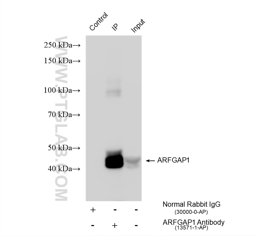 IP experiment of LNCaP using 13571-1-AP Immunoprecipitation (IP) experiment of LNCaP cells using ARFGAP1 Polyclonal antibody (13571-1-AP)