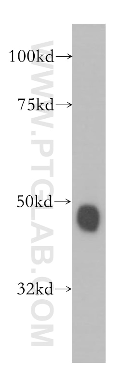 Western Blot (WB) analysis of human brain tissue using ARFGAP1 Polyclonal antibody (13571-1-AP)