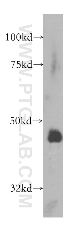 Western Blot (WB) analysis of HeLa cells using ARFGAP1 Polyclonal antibody (13571-1-AP)