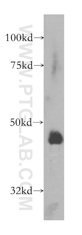 WB analysis of HeLa using 13571-1-AP