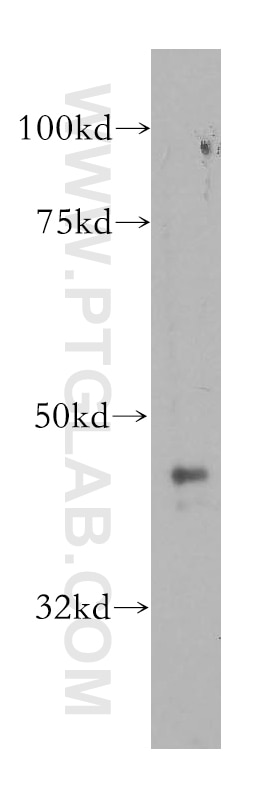 Western Blot (WB) analysis of PC-3 cells using ARFGAP1 Polyclonal antibody (13571-1-AP)