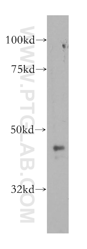 WB analysis of PC-3 using 13571-1-AP