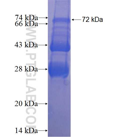ARFGAP1 fusion protein Ag4468 SDS-PAGE