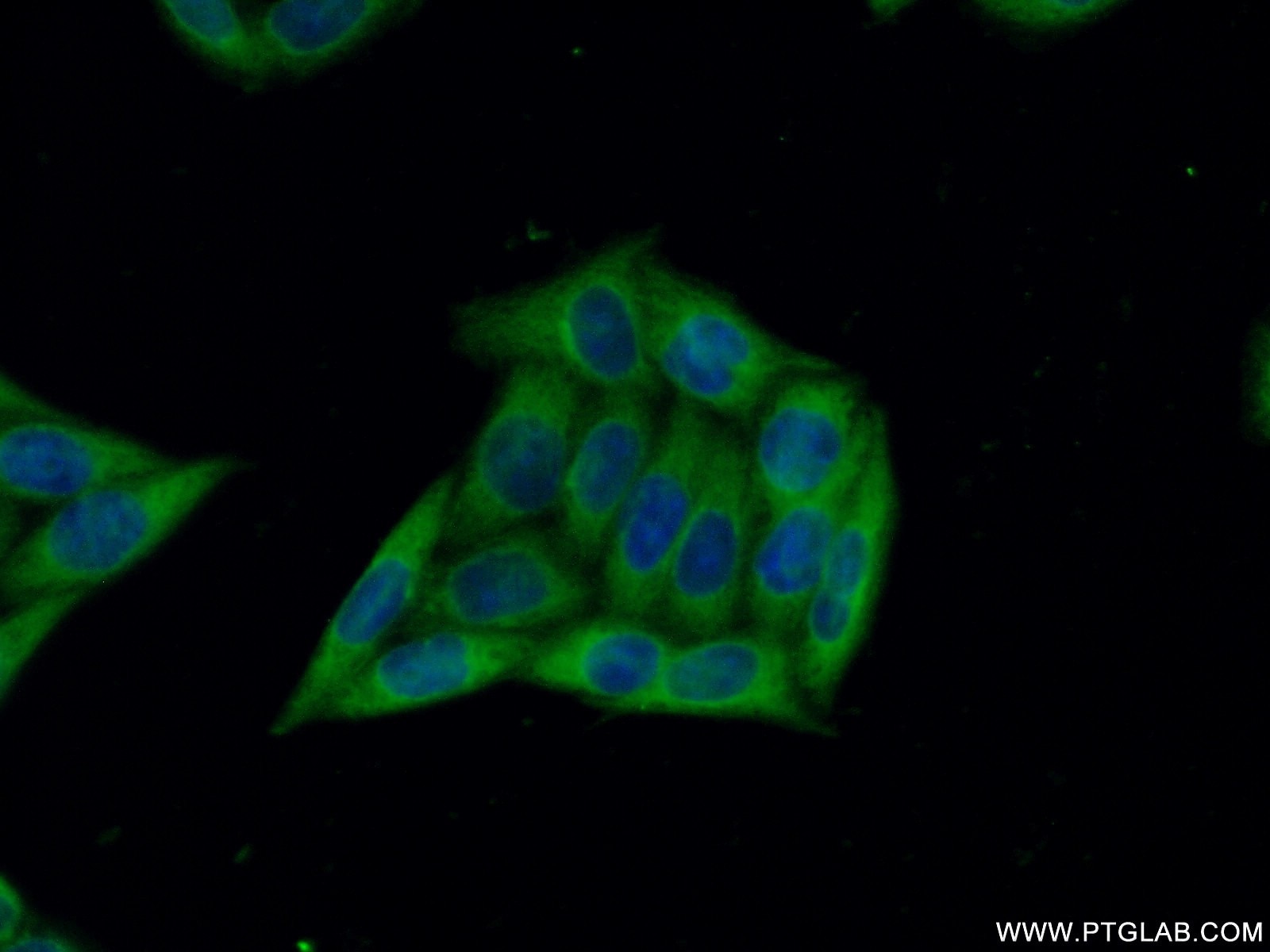 Immunofluorescence (IF) / fluorescent staining of HeLa cells using ARFGAP2 Polyclonal antibody (16519-1-AP)