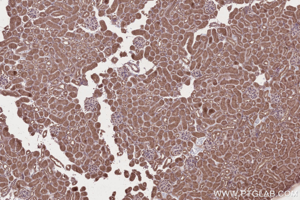 IHC staining of mouse kidney using 16519-1-AP Immunohistochemistry (IHC) staining of mouse kidney tissue using ARFGAP2 Polyclonal antibody (16519-1-AP)