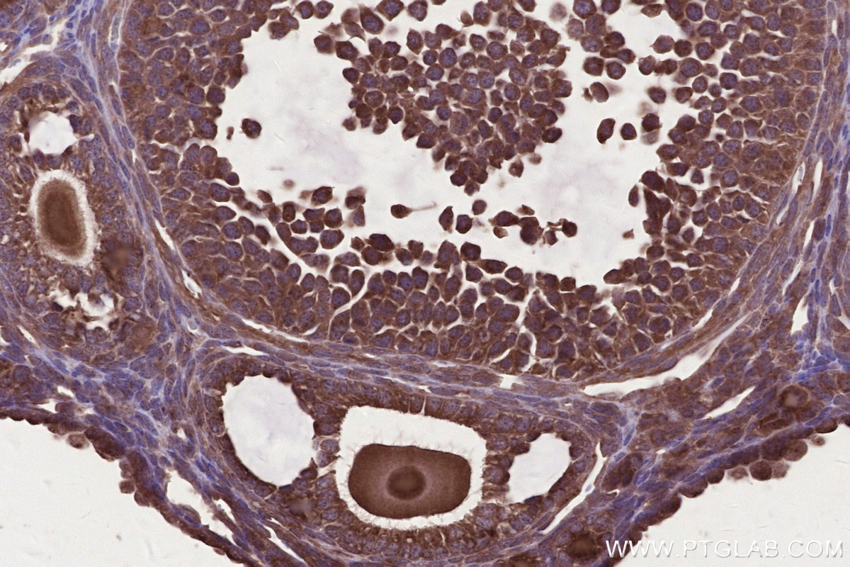 IHC staining of mouse ovary using 16519-1-AP Immunohistochemistry (IHC) staining of mouse ovary tissue using ARFGAP2 Polyclonal antibody (16519-1-AP)