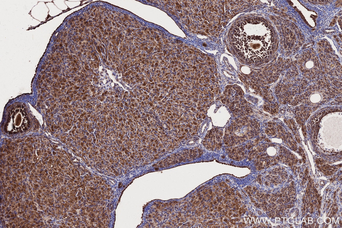 IHC staining of rat ovary using 16519-1-AP Immunohistochemistry (IHC) staining of rat ovary tissue using ARFGAP2 Polyclonal antibody (16519-1-AP)