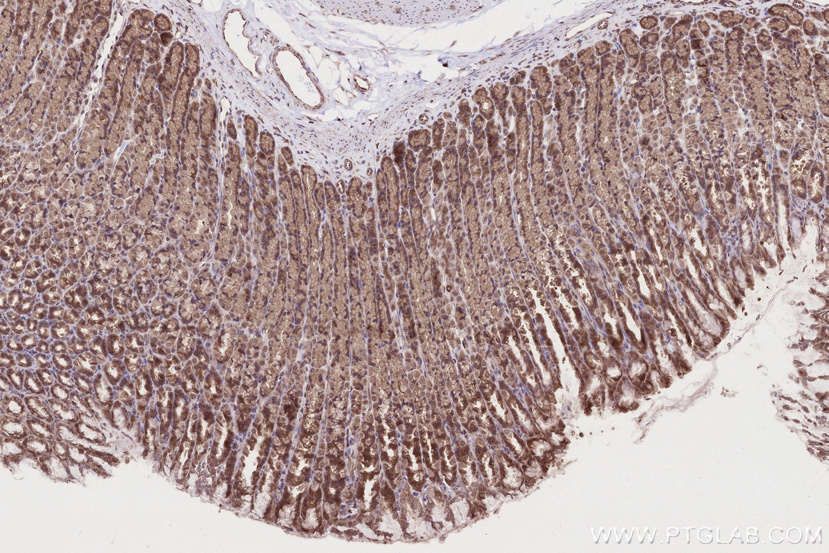 IHC staining of rat stomach using 16519-1-AP Immunohistochemistry (IHC) staining of rat stomach tissue using ARFGAP2 Polyclonal antibody (16519-1-AP)