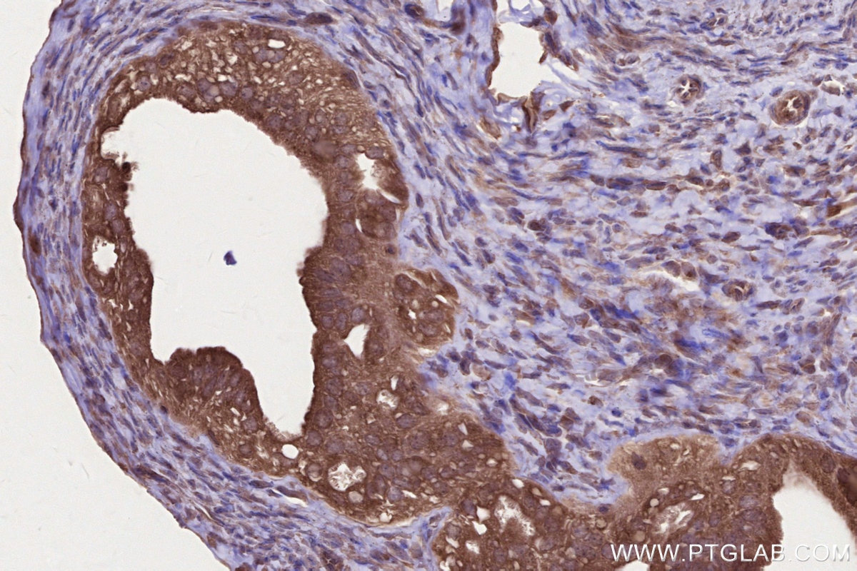 IHC staining of mouse ovary using 16519-1-AP Immunohistochemistry (IHC) staining of mouse ovary tissue using ARFGAP2 Polyclonal antibody (16519-1-AP)