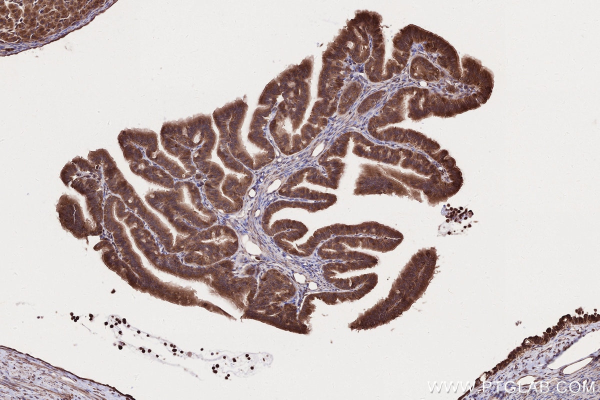 IHC staining of rat ovary using 16519-1-AP Immunohistochemistry (IHC) staining of rat ovary tissue using ARFGAP2 Polyclonal antibody (16519-1-AP)