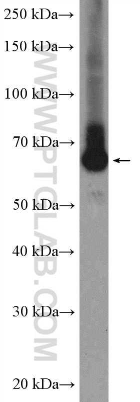 Western Blot (WB) analysis of mouse brain tissue using ARFGAP2 Polyclonal antibody (16519-1-AP)