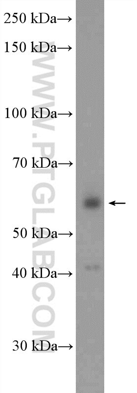 Western Blot (WB) analysis of HeLa cells using ARFGAP2 Polyclonal antibody (16519-1-AP)