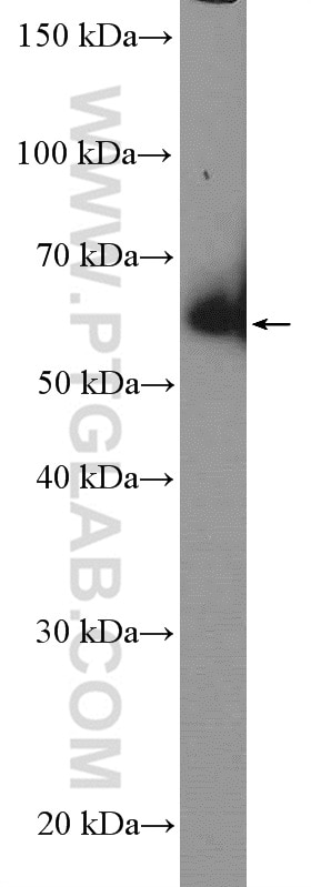 Western Blot (WB) analysis of HeLa cells using ARFGAP2 Polyclonal antibody (16519-1-AP)