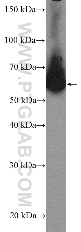 Western Blot (WB) analysis of HeLa cells using ARFGAP2 Polyclonal antibody (16519-1-AP)